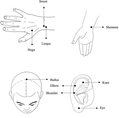 Effects of acupuncture and nicotine patch on smoking: a multicenter, randomized, controlled, double-blind clinical trial